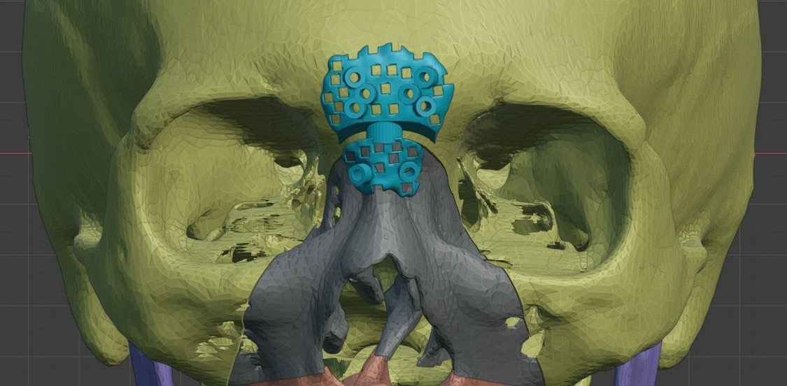 Z5943872467540 38f91983fd23e1ef99675ca0b592918e